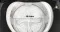 Panasonic NA-F100VD1BB 10 Kg Fully Automatic Top Load Washing Machine